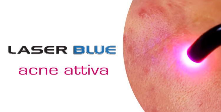 trattamento laser blue acne attiva